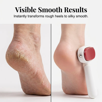 Say Goodbye to Rough, Cracked Heels — Reveal Softer, Smoother Feet in Minutes ✨